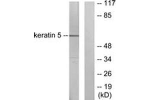 Western blot analysis of extracts from HepG2 cells, using Keratin 5 Antibody. (Cytokeratin 5 anticorps  (AA 541-590))