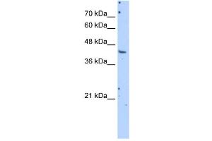 GOT1 antibody used at 5 ug/ml to detect target protein.