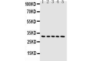 Anti-Caspase-6(P18) antibody, Western blotting Lane 1: MCF-7 Cell Lysate Lane 2: HELA Cell Lysate Lane 3: JURKAT Cell Lysate Lane 4: CEM Cell Lysate Lane 5: SW620 Cell Lysate (Caspase 6 anticorps  (N-Term))