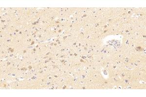 #VALUE! (TMPRSS2 anticorps  (AA 284-492))