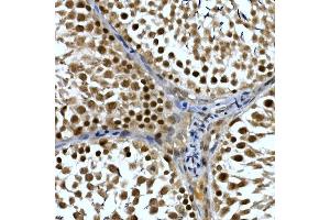 Immunohistochemistry of paraffin-embedded rat testis using NELFCD Rabbit pAb (ABIN1683024, ABIN3019182, ABIN3019183 and ABIN6220747) at dilution of 1:50 (40x lens). (TH1-Like anticorps  (AA 355-599))
