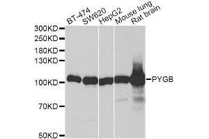 Western blot analysis of extracts of various cell lines, using PYGB antibody. (PYGB anticorps  (AA 544-843))