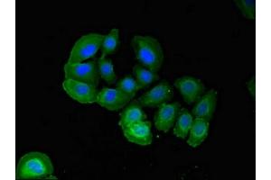 Immunofluorescent analysis of A549 cells using ABIN7162663 at dilution of 1:100 and Alexa Fluor 488-congugated AffiniPure Goat Anti-Rabbit IgG(H+L)