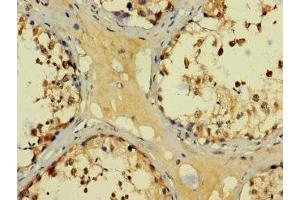 Immunohistochemistry of paraffin-embedded human testis tissue using ABIN7145137 at dilution of 1:100 (BAGE3 anticorps  (AA 18-109))