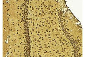 ABIN6275688 at 1/100 staining Mouse brain tissue by IHC-P.