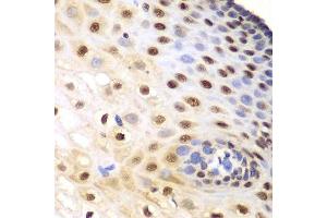 Immunohistochemistry of paraffin-embedded human esophagus using KPNA1 antibody.