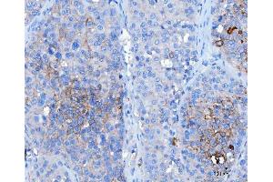 IHC analysis of Desmoglein 2/DSG2 using anti-Desmoglein 2/DSG2 antibody (ABIN7600804). (Desmoglein 2 anticorps  (AA 24-1020))