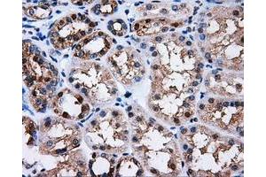 Immunohistochemical staining of paraffin-embedded Kidney tissue using anti-PPME1mouse monoclonal antibody. (PPME1 anticorps)