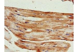 Immunohistochemistry of paraffin-embedded human skeletal muscle tissue using ABIN7157595 at dilution of 1:100 (KIF14 anticorps  (AA 261-531))