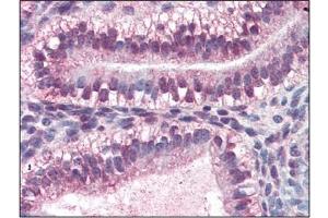 Immunohistochemistry (IHC) image for anti-Cellular Retinoic Acid Binding Protein 2 (CRABP2) (AA 1-138), (N-Term) antibody (ABIN356224)