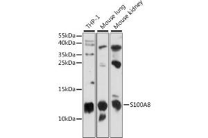 Western blot analysis of extracts of various cell lines, using S100 antibody (ABIN7270129) at 1:1000 dilution. (S100A8 anticorps  (AA 1-93))