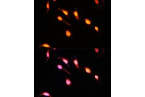 Immunofluorescence analysis of U-2 OS cells using GTF3C4 Polyclonal Antibody  at dilution of 1:100 (40x lens).