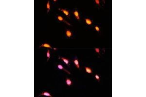 Immunofluorescence analysis of U-2 OS cells using GTF3C4 Polyclonal Antibody  at dilution of 1:100 (40x lens). (GTF3C4 anticorps  (AA 583-822))