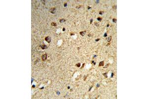 Immunohistochemistry (IHC) image for anti-Nuclear Receptor Coactivator 7 (NCOA7) antibody (ABIN3004220)
