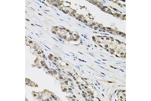 Immunohistochemistry of paraffin-embedded human prostate using TCEB1 antibody (ABIN6131624, ABIN6148930, ABIN6148932 and ABIN6219151) (40x lens). (TCEB1 anticorps  (AA 1-112))