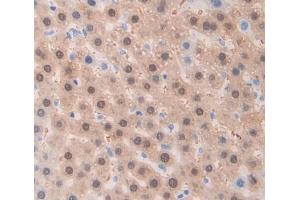 Used in DAB staining on fromalin fixed paraffin- embedded Kidney tissue (ADAM1 anticorps  (AA 463-727))