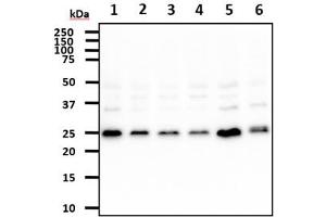 The cell lysates (40ug) were resolved by SDS-PAGE, transferred to PVDF membrane and probed with anti-human REXO2 antibody (1:500). (REXO2 anticorps)
