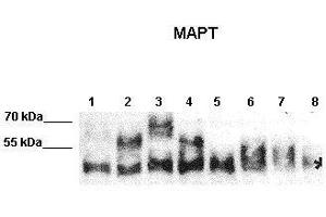 WB Suggested Anti-MAPT Antibody    Positive Control:  Lane 1: 10ug N2A expressed human Tau-C Lane 2: 10ug N2A expressed human Tau-E Lane 3: 10ug N2A expressed human Tau-F Lane 4: 10ug N2A expressed human Tau-B Lane 5: 10ug N2A expressed human Fetal-Tau Lane 6: 10ug N2A expressed human Tau-D Lane 7: 10ug N2A expressed human much Fetal-Tau Lane 8: 10ug N2A lysate   Primary Antibody Dilution :   1:2000  Secondary Antibody :  Donkey anti-rabbit-HRP   Secondry Antibody Dilution :   1:10,000   Submitted by:  Max Holzer, Paul Flechsig Institut of Brain Research, University of Leipzig