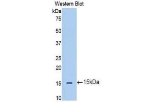 Detection of Recombinant IL13Ra2, Human using Polyclonal Antibody to Interleukin 13 Receptor Alpha 2 (IL13Ra2)