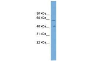 Image no. 1 for anti-Solute Carrier Family 22, Member 10 (SLC22A10) (AA 431-480) antibody (ABIN6744750) (SLC22A10 anticorps  (AA 431-480))