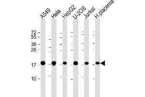 All lanes : Anti-COD1 Antibody (N-Term) at 1:2000 dilution Lane 1: A549 whole cell lysate Lane 2: Hela whole cell lysate Lane 3: HepG2 whole cell lysate Lane 4: U-2OS whole cell lysate Lane 5: Jurkat whole cell lysate Lane 6: human placenta lysate Lysates/proteins at 20 μg per lane. (COMMD1 anticorps)
