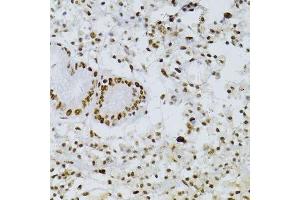 Immunohistochemistry of paraffin-embedded human stomach using SNRNP70 antibody.