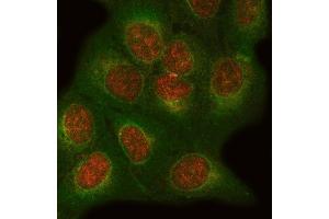 IF analysis of ONECUT1 and Tubulin beta using anti-ONECUT1 antibody (ABIN7599190) and anti-Tubulin beta antibody (ABIN7602744).