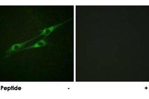 Immunofluorescence analysis of NIH/3T3 cells, using IL13RA1 polyclonal antibody . (IL13 Receptor alpha 1 anticorps)