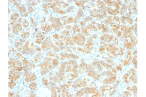 Formalin-fixed, paraffin-embedded human Pancreas stained with GP2 Recombinant Rabbit Monoclonal Antibody (GP2/2569R). (Recombinant GP2 anticorps  (AA 35-179))