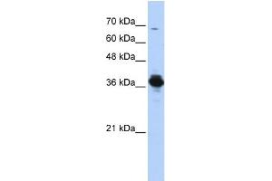 WB Suggested Anti-ATP6V0D2 Antibody Titration: 0. (ATP6V0D2 anticorps  (Middle Region))