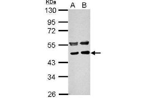 WB Image Sample (30 ug of whole cell lysate) A: NIH-3T3 B: JC 10% SDS PAGE antibody diluted at 1:1000 (PPME1 anticorps)