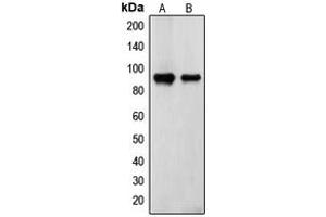 Western blot analysis of Transglutaminase 2 expression in ECV304 (A), TF1 (B) whole cell lysates. (Transglutaminase 2 anticorps  (N-Term))