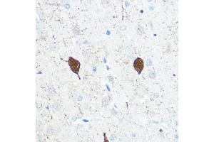 Immunohistochemistry of paraffin-embedded Rat brain using Parvalbumin (Parvalbumin (PVALB)) Rabbit pAb (ABIN3016700, ABIN3016701, ABIN3016702 and ABIN6219820) at dilution of 1:100 (40x lens). (PVALB anticorps)