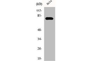 Western Blot analysis of HeLa cells using Phospho-Btk (Y551) Polyclonal Antibody