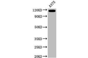 Western Blot Positive WB detected in A375 whole cell lysate All lanes CD146 antibody at 0.