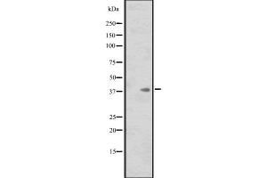Western blot analysis of ISL1 expression in HL60 whole cell lysate ,The lane on the left is treated with the antigen-specific peptide. (ISL1 anticorps  (Internal Region))
