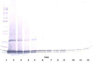 Image no. 2 for anti-Interleukin 17B (IL17B) antibody (ABIN465608) (IL17B anticorps)