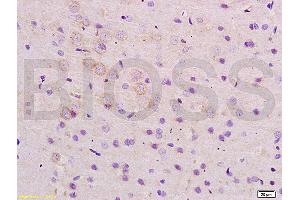 Formalin-fixed and paraffin embedded rat brain tissue labeled with Anti-ARHGAP32 Polyclonal Antibody, Unconjugated (ABIN1386112) at 1:200 followed by conjugation to the secondary antibody and DAB staining (ARHGAP32 anticorps  (AA 860-896))