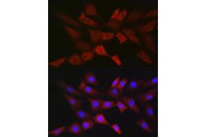 Immunofluorescence analysis of NIH/3T3 cells using PGD Rabbit mAb (ABIN7269315) at dilution of 1:100 (40x lens). (PGD anticorps)