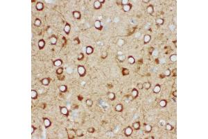 Anti- IP3 receptor antibody,IHC(P) IHC(P): Mouse Brain Tissue