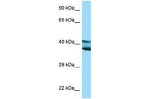 Image no. 1 for anti-Ly1 Antibody Reactive (LYAR) (AA 81-130) antibody (ABIN6748222) (LYAR anticorps  (AA 81-130))