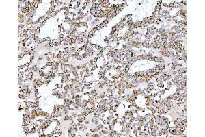IHC analysis of SUCLG2 using anti-SUCLG2 antibody (ABIN7601694). (SUCLG2 anticorps  (AA 42-424))