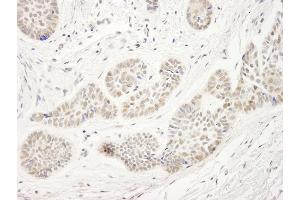 Immunohistochemistry (IHC) image for anti-Ubiquitin-Like, Containing PHD and RING Finger Domains, 1 (UHRF1) (AA 275-325) antibody (ABIN7448698)