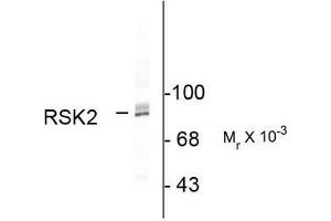 Image no. 1 for anti-Ribosomal Protein S6 Kinase, 90kDa, Polypeptide 3 (RPS6KA3) (C-Term) antibody (ABIN372713) (RPS6KA3 anticorps  (C-Term))