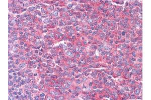 Immunohistochemical analysis of paraffin-embedded human Tonsil tissues using KARS mouse mAb (KARS anticorps)