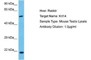 Host:  Mouse  Target Name:  KRT14  Sample Tissue:  Mouse Testis  Antibody Dilution:  1ug/ml (KRT14 anticorps  (C-Term))