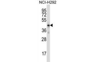 Western Blotting (WB) image for anti-Homeobox D10 (HOXD10) antibody (ABIN2997889) (HOXD10 anticorps)