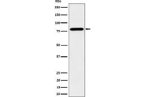 Western blot analysis of PRMT7 expression in HeLa cell lysate.