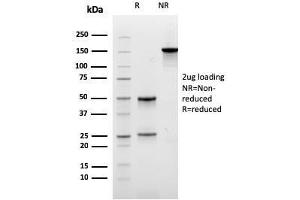 SDS-PAGE Analysis of Purified Carboxypeptidase A1 / CPA1 Mouse Monoclonal Antibody (CPA1/2711).