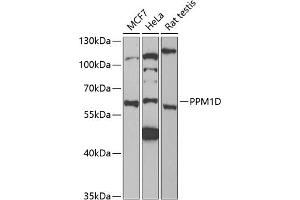 Western blot analysis of extracts of various cell lines, using PPM1D antibody (ABIN6132824, ABIN6146041, ABIN6146042 and ABIN6221792) at 1:1000 dilution. (PPM1D anticorps  (AA 1-250))